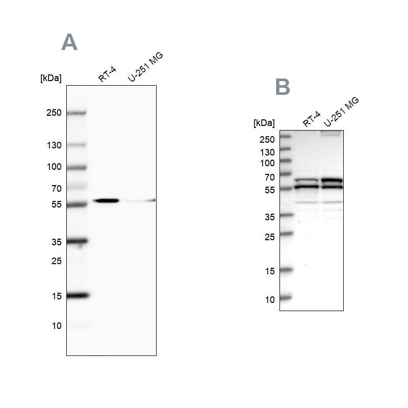 <b>Independent Antibodies Validation. </b>Analysis using Anti-CALCOCO2 antibody NBP1-87872 (A) shows similar pattern to independent antibody NBP1-87874 (B).