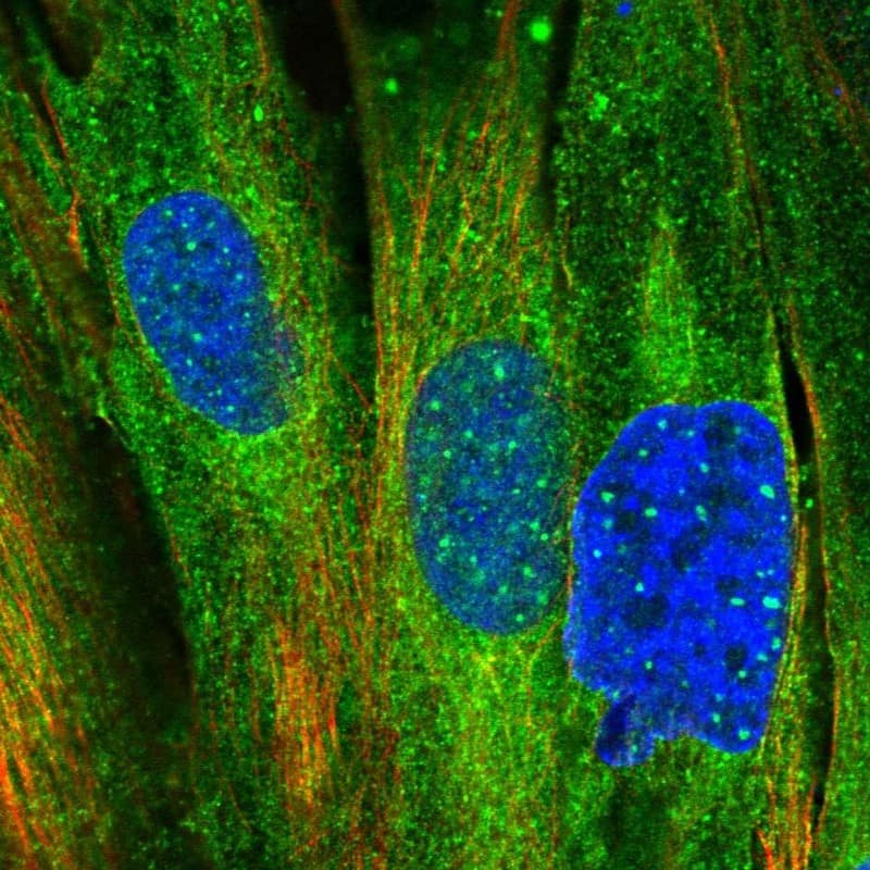 Staining of human cell line BJ shows localization to nuclear bodies & cytosol.