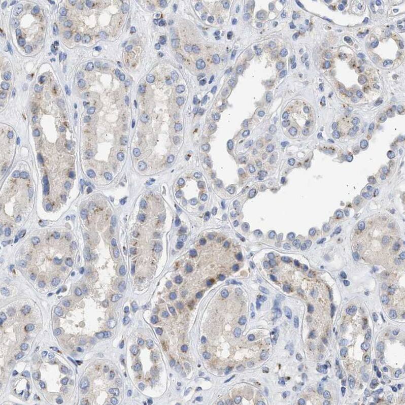 Staining of human kidney shows weak granular cytoplasmic positivity in cells in tubules.