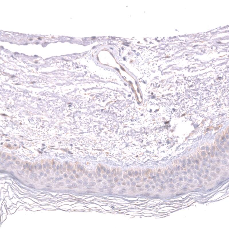 Staining of human skin shows very weak cytoplasmic positivity in squamous epithelial cells.