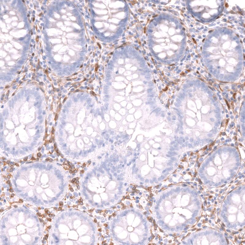 Staining of human colon shows strong cytoplasmic positivity in lymphoid cells.