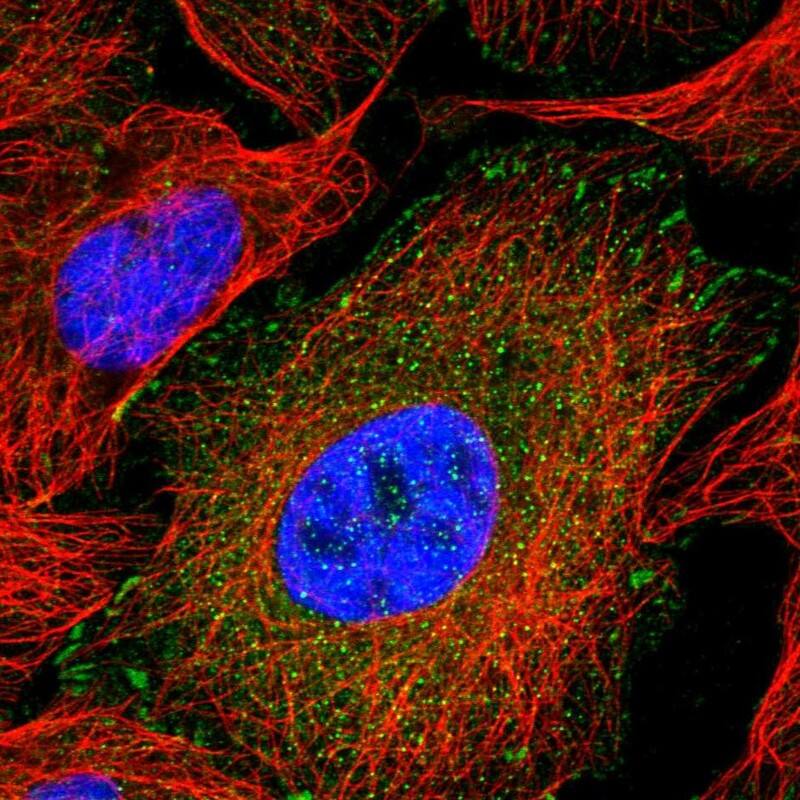 Staining of human cell line U-2 OS shows localization to nucleoplasm & focal adhesion sites.