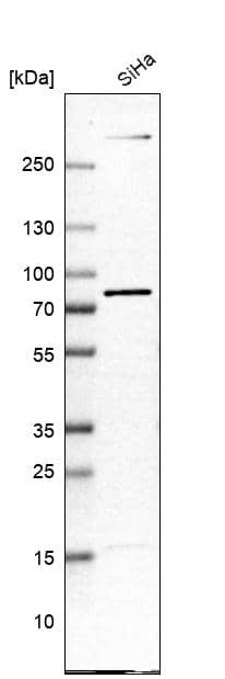 Analysis in human cell line SiHa.