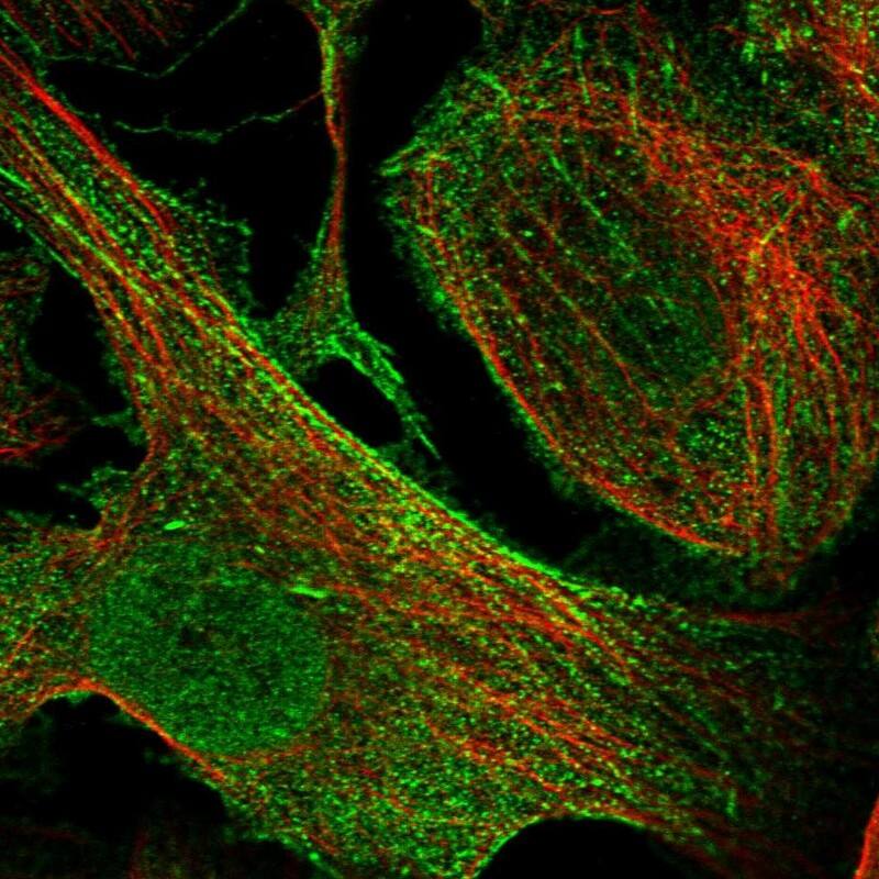 Staining of human cell line U-2 OS shows localization to nucleoplasm, cytosol & actin filaments.