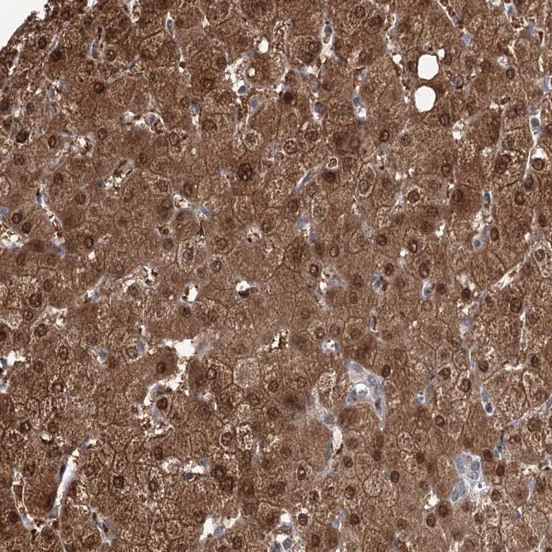 Staining of human Liver shows strong granular cytoplasmic positivity in hepatocytes.