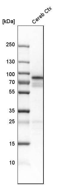 Analysis in human cerebral cortex tissue.