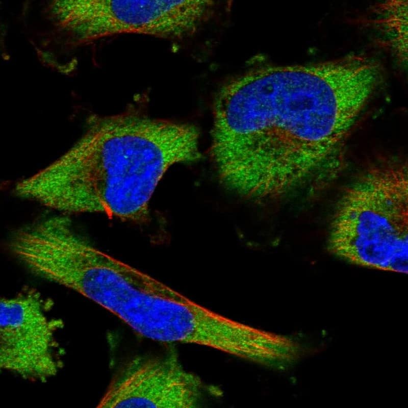 Immunocytochemistry/ Immunofluorescence LARP5 Antibody - BSA Free