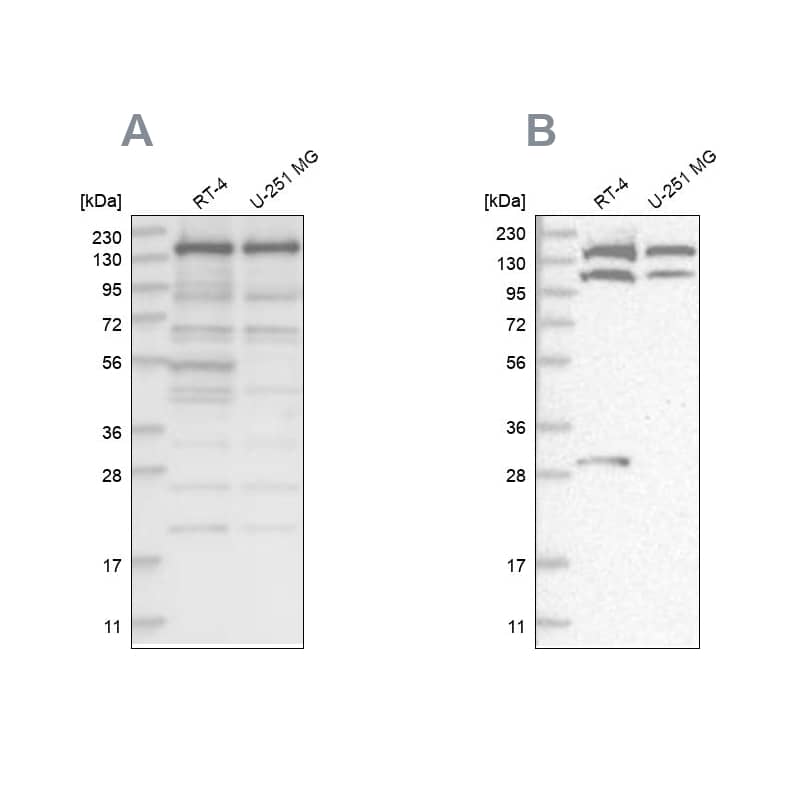 Western Blot SCC112 Antibody - BSA Free