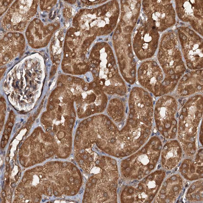 Immunohistochemistry-Paraffin FLJ11506 Antibody - BSA Free