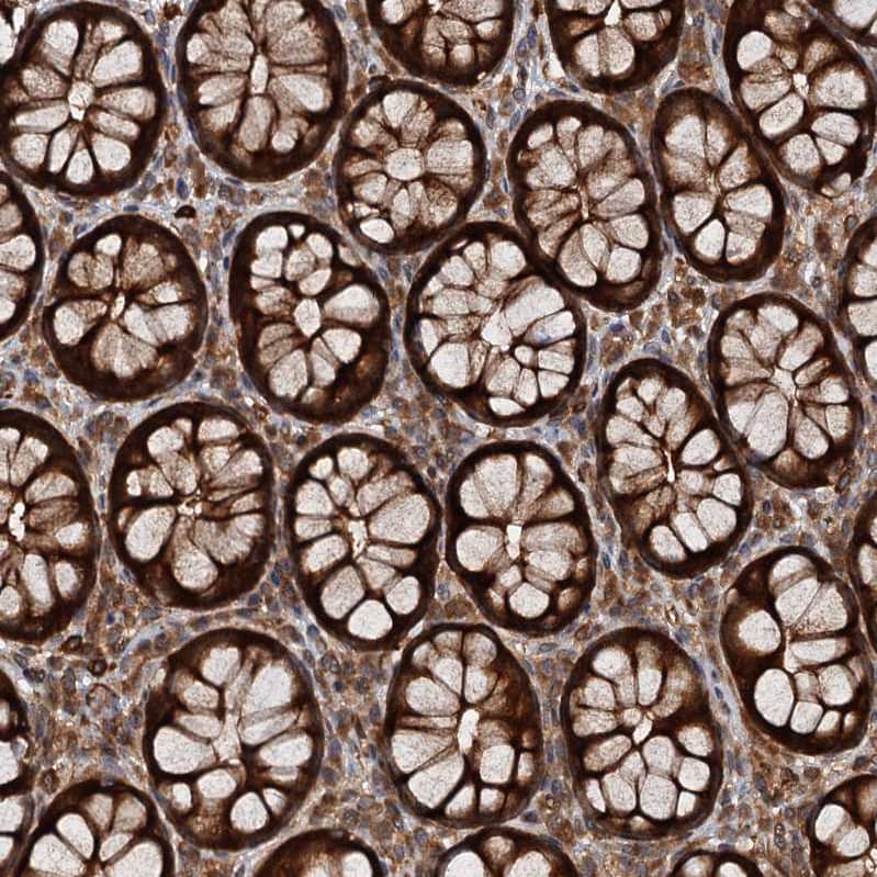 Immunohistochemistry-Paraffin FLJ11506 Antibody - BSA Free