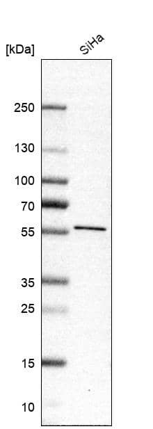 Analysis in human cell line SiHa.