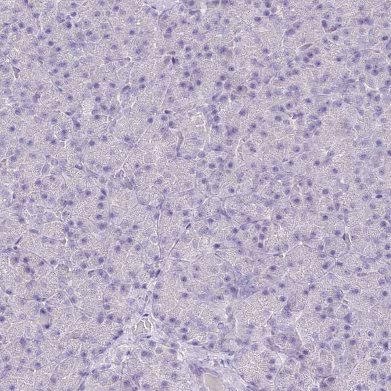 Immunohistochemistry-Paraffin FLJ10808 Antibody - BSA Free