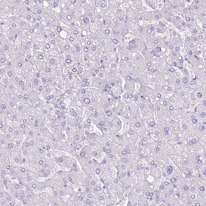 Immunohistochemistry-Paraffin FLJ10808 Antibody - BSA Free