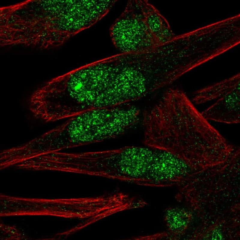Staining of human cell line RH-30 shows localization to nucleoplasm & nuclear bodies.