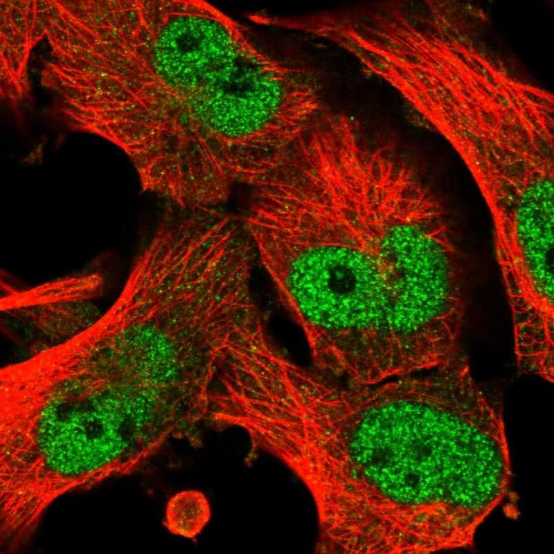Immunocytochemistry/ Immunofluorescence ABC2 Antibody - BSA Free