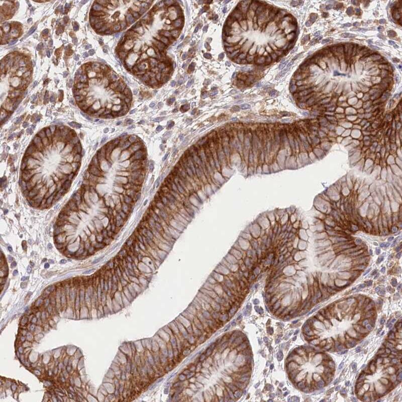 Staining of human stomach shows strong cytoplasmic and membrane positivity in glandular cells.