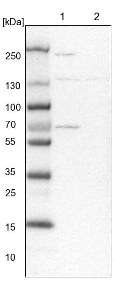 Lane 1: NIH-3T3 cell lysate (Mouse embryonic fibroblast cells)Lane 2: NBT-II cell lysate (Rat Wistar bladder tumour cells)