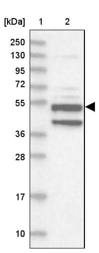 Lane 1: Marker [kDa] 250, 130, 95, 72, 55, 36, 28, 17, 10Lane 2: Human cell line RT-4