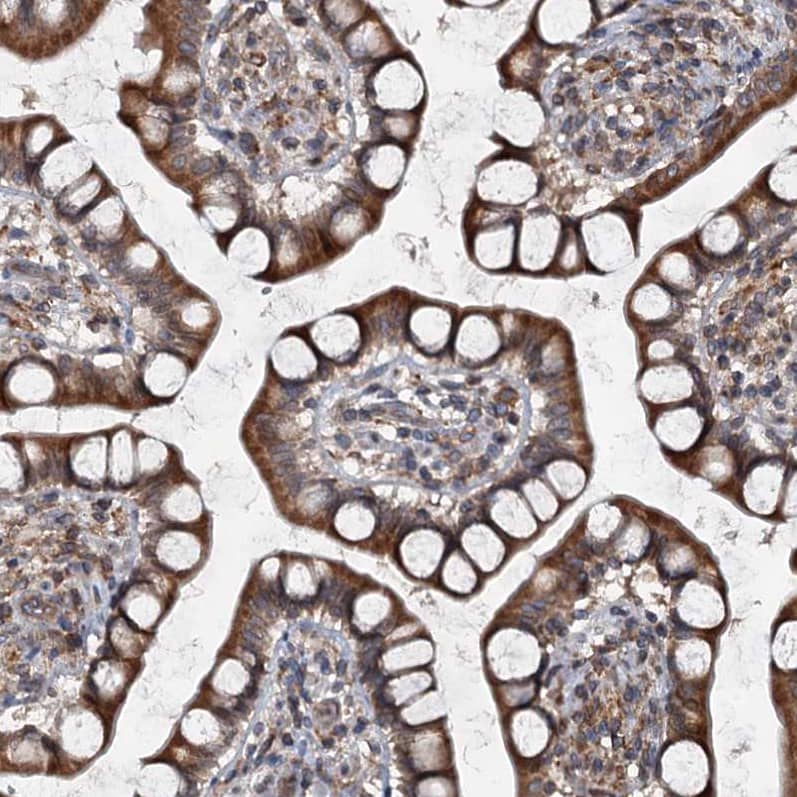 Staining of human small intestine shows moderate cytoplasmic positivity in glandular cells.