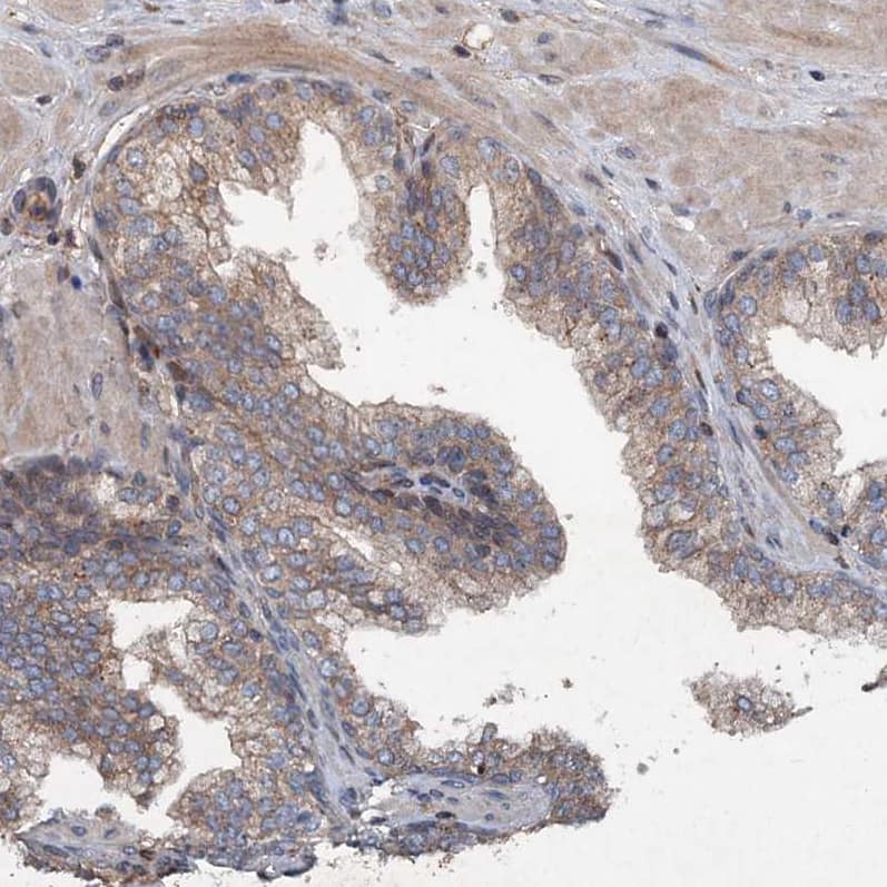 Staining of human prostate shows weak cytoplasmic positivity in glandular cells.