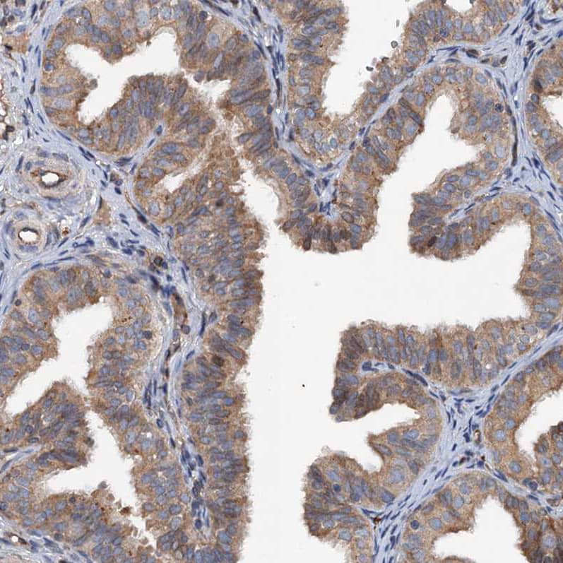 Staining of human fallopian tube shows moderate cytoplasmic positivity in glandular cells.