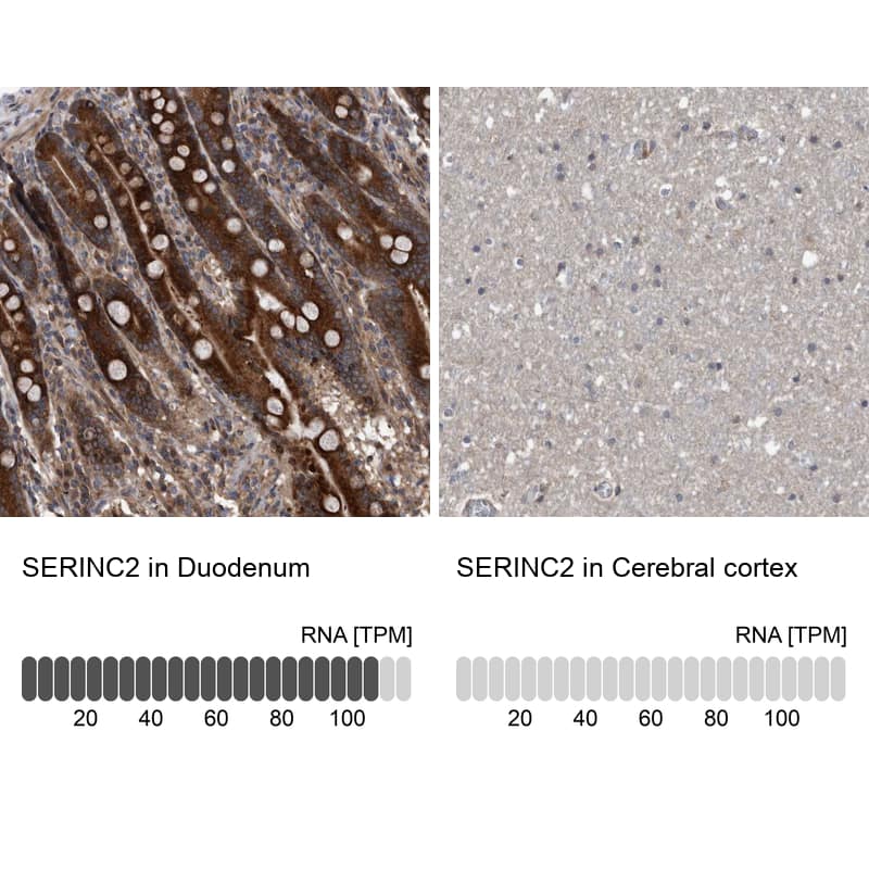Immunohistochemistry-Paraffin SERINC2 Antibody - BSA Free