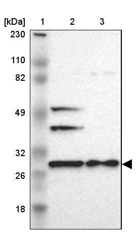 Lane 1: Marker [kDa] 230, 110, 82, 49, 32, 26, 18Lane 2: Human cell line RT-4Lane 3: Human cell line U-251MG sp