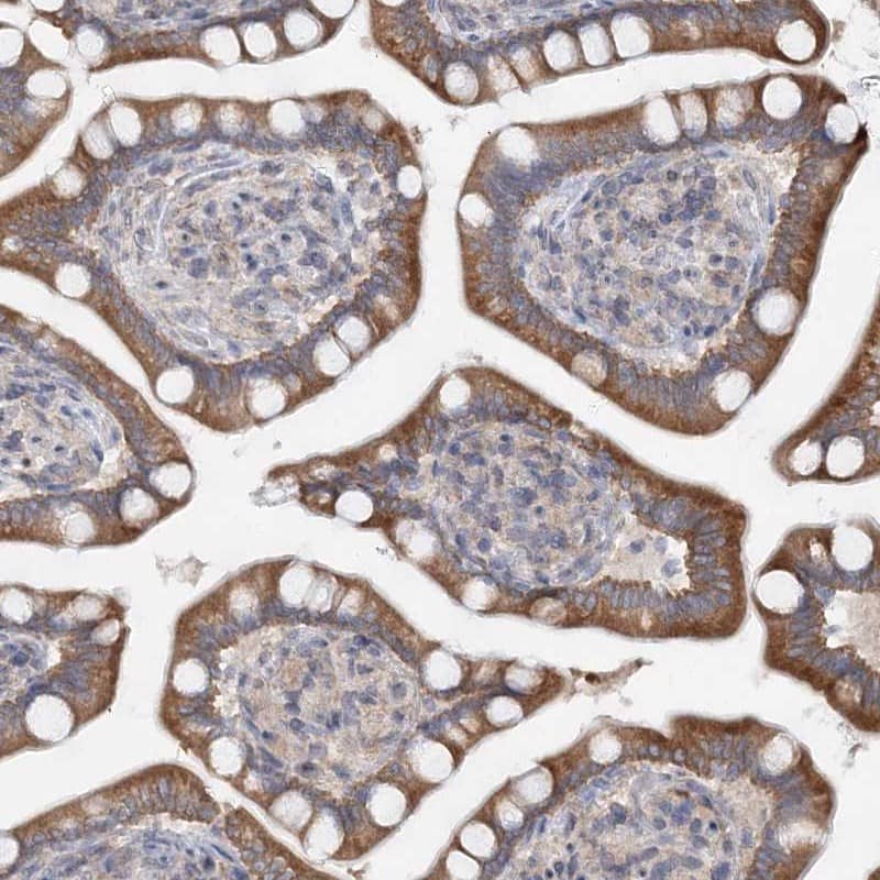 Staining of human small intestine shows moderate cytoplasmic positivity in glandular cells.