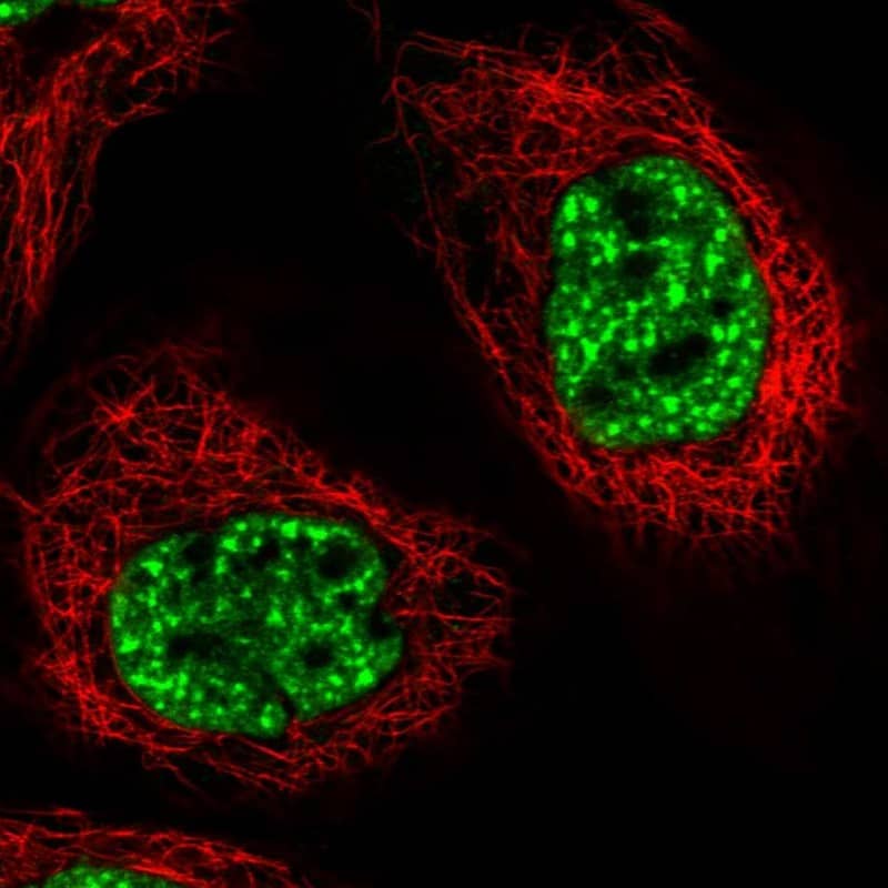 Staining of human cell line A-431 shows localization to nuclear speckles.