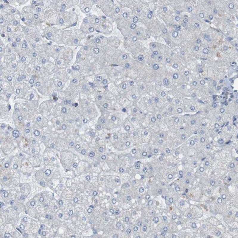 Staining of human liver shows no positivity in hepatocytes as expected.