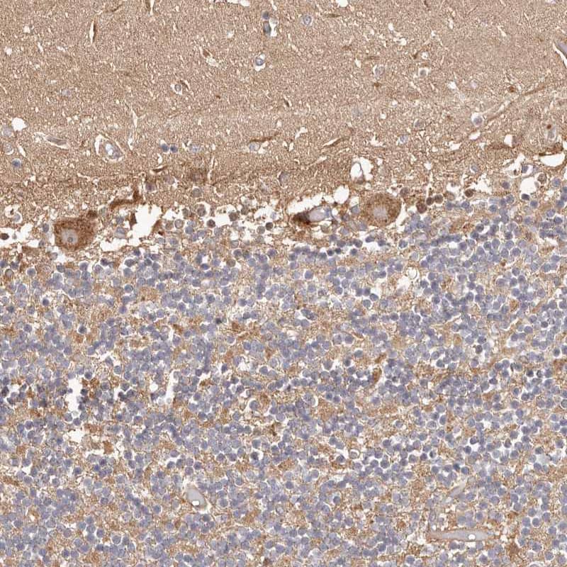Staining of human cerebellum shows moderate cytoplasmic positivity in Purkinje cells.