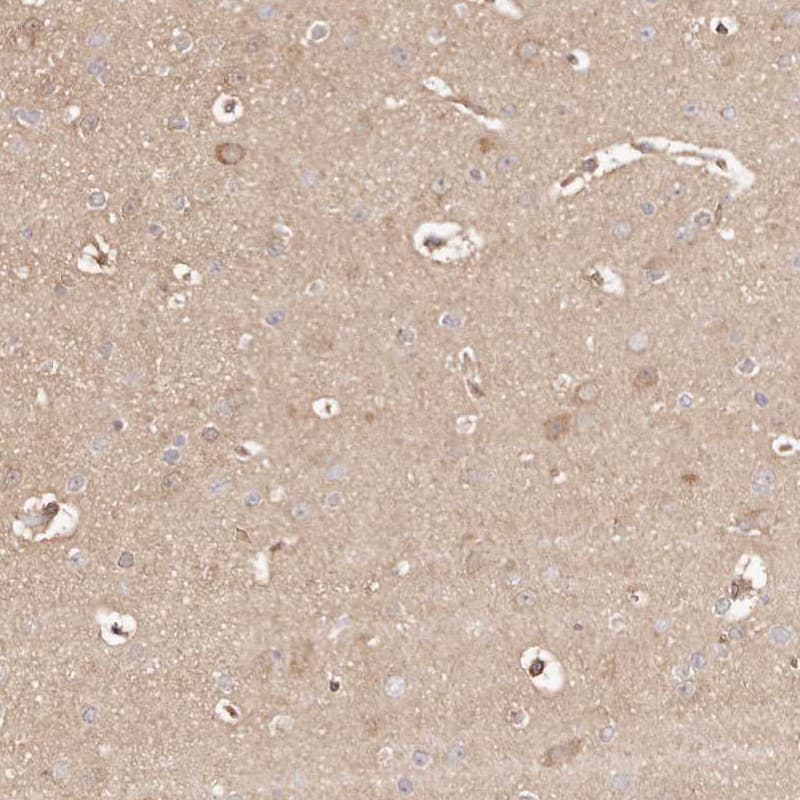 Staining of human cerebral cortex shows weak cytoplasmic positivity in neuronal cells.
