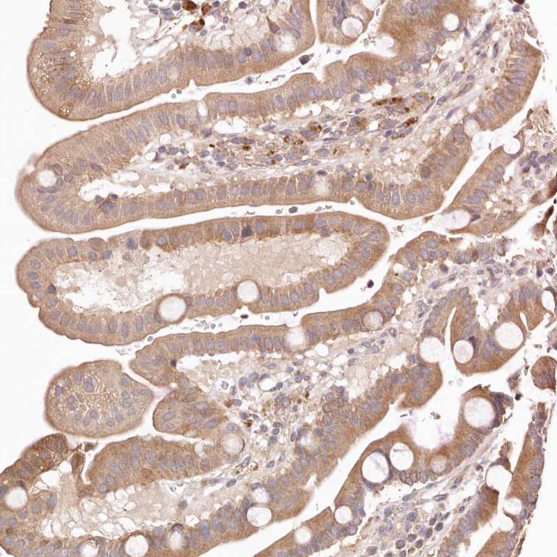 Staining of human duodenum shows moderate cytoplasmic positivity in glandular cells.