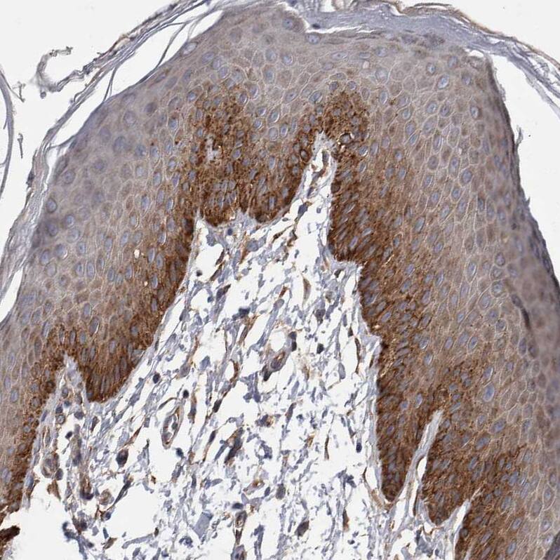 Immunohistochemistry-Paraffin EPLIN Antibody - BSA Free