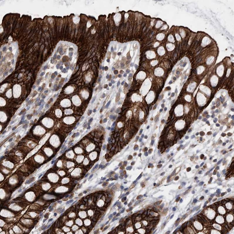 Staining of human rectum shows strong membranous and cytoplasmic positivity in glandular cells.