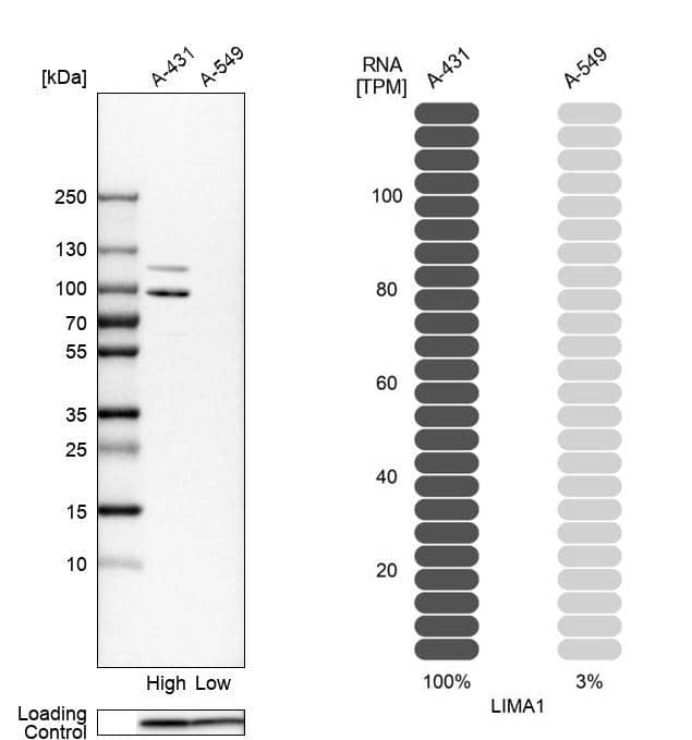 <b>Orthogonal Strategies Validation. </b>Analysis in human cell lines A-431 and A-549 using Anti-LIMA1 antibody. Corresponding LIMA1 RNA-seq data are presented for the same cell lines. Loading control: Anti-PPIB.
