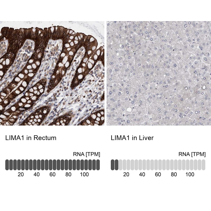 <b>Orthogonal Strategies Validation. </b>Analysis in human rectum and liver tissues using HPA023871 antibody. Corresponding LIMA1 RNA-seq data are presented for the same tissues.