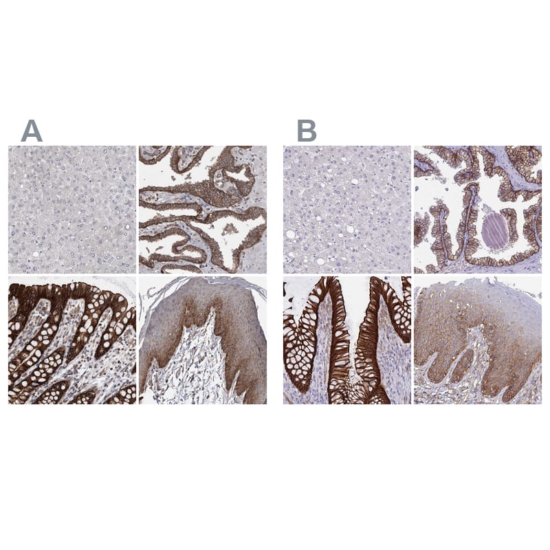<b>Independent Antibodies Validation. </b>Staining of human liver, prostate, rectum and squamous epithelia using Anti-LIMA1 antibody NBP1-87947 (A) shows similar protein distribution across tissues to independent antibody NBP2-38673 (B).