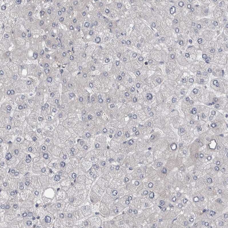 Staining of human liver shows very weak membranous positivity in hepatocytes.