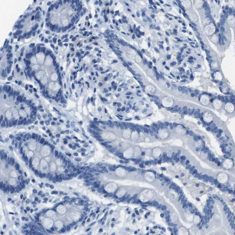 Immunohistochemistry-Paraffin Enteropeptidase/Enterokinase Antibody - BSA Free