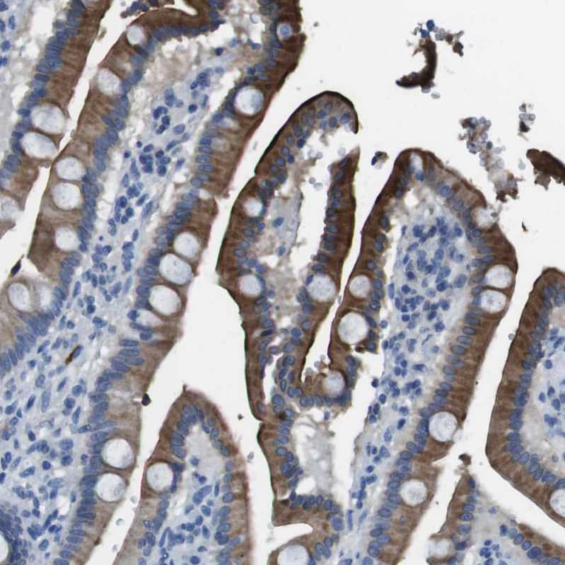 Immunohistochemistry-Paraffin Enteropeptidase/Enterokinase Antibody - BSA Free