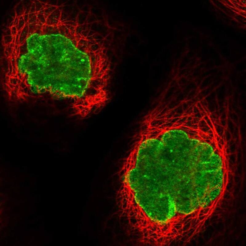 Staining of human cell line A-431 shows localization to nuclear membrane.