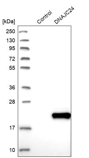Western Blot DPH4 Antibody - BSA Free