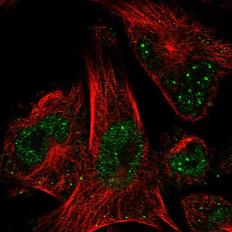 Staining of human cell line U-251 MG shows localization to nucleoplasm, nuclear bodies & vesicles.