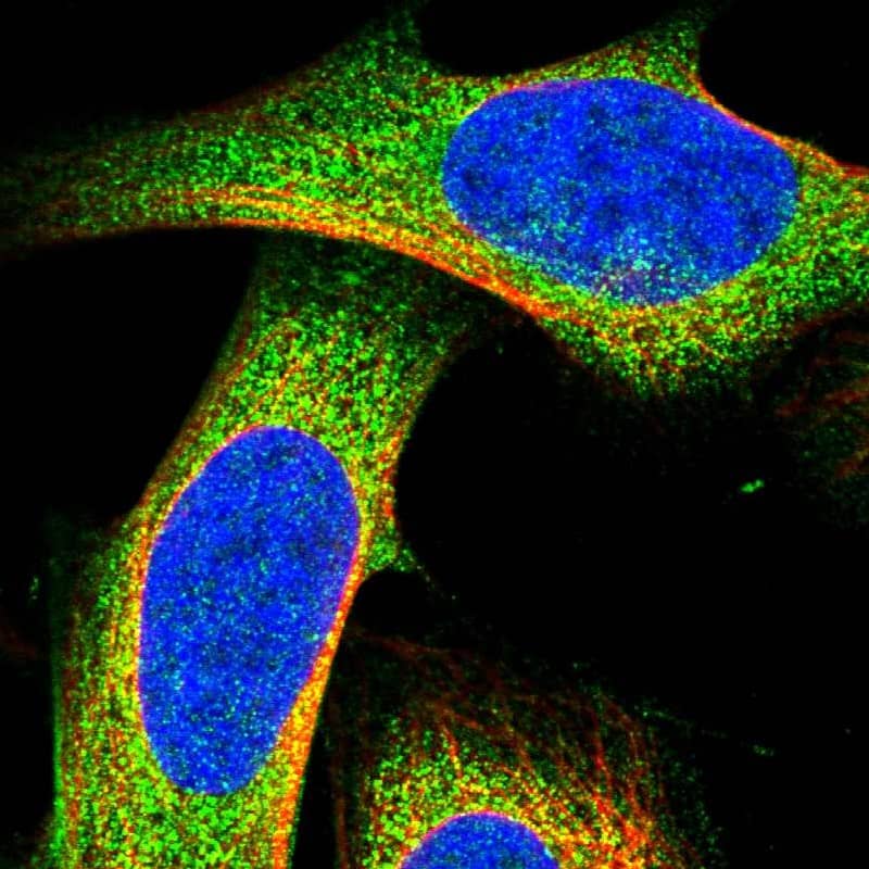 Immunocytochemistry/ Immunofluorescence DLC1/DLEC1 Antibody