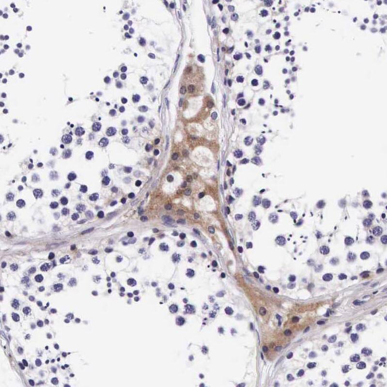 Staining of human testis shows strong cytoplasmic positivity in Leydig cells.