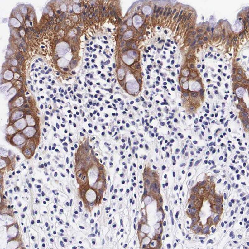 Staining of human rectum shows strong cytoplasmic positivity in glandular cells.