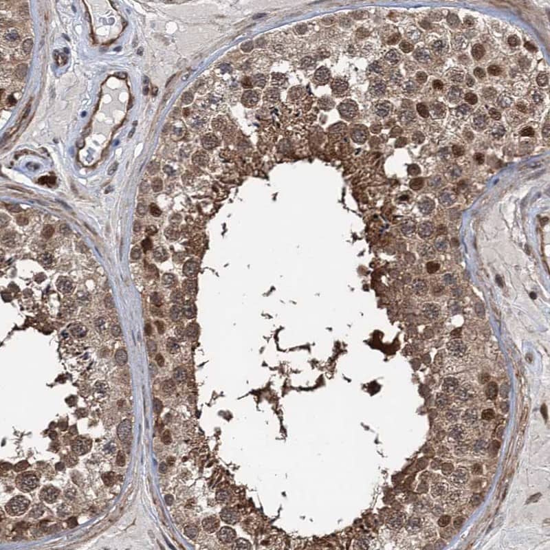 Immunohistochemistry-Paraffin GPBP Antibody - BSA Free