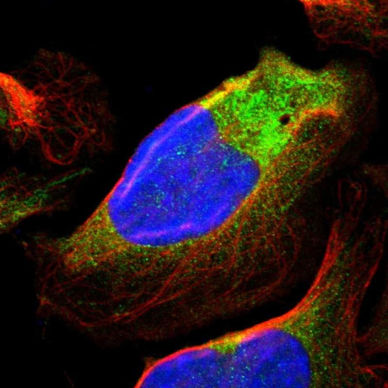 Staining of human cell line U-2 OS shows localization to cytosol & mitochondria.