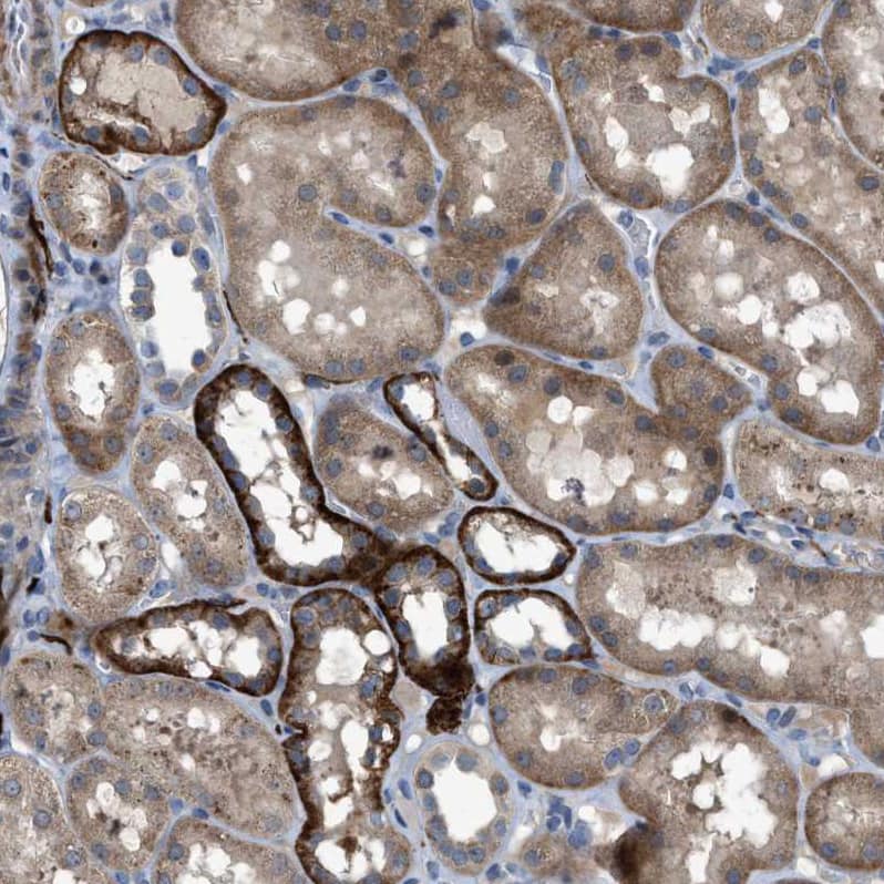 Staining of human kidney shows moderate to strong cytoplasmic positivity in cells in tubules.